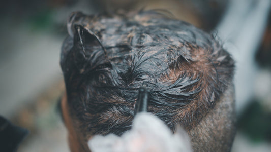 Blog: Trattamento Curativo per la Cute Uomo - La Base per Capelli Sani - Mat Parrucchieri