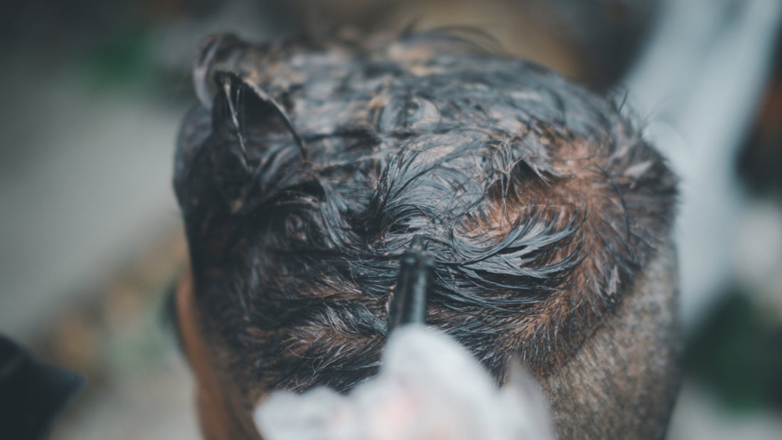 Blog: Trattamento Curativo per la Cute Uomo - La Base per Capelli Sani - Mat Parrucchieri